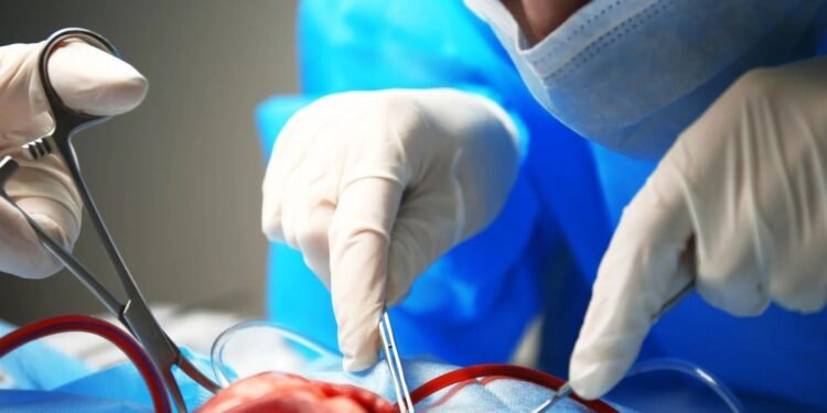 Yucatán, Medicina, Trasplante, Trasplante de Corazón