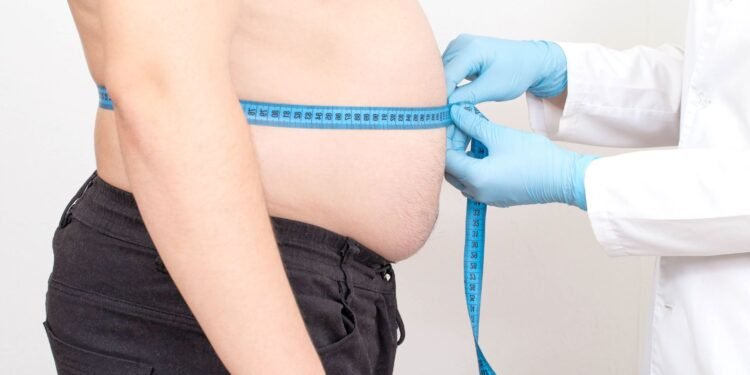 Yucatán gana peso en las estadísticas: detectan 56 casos de obesidad cada día